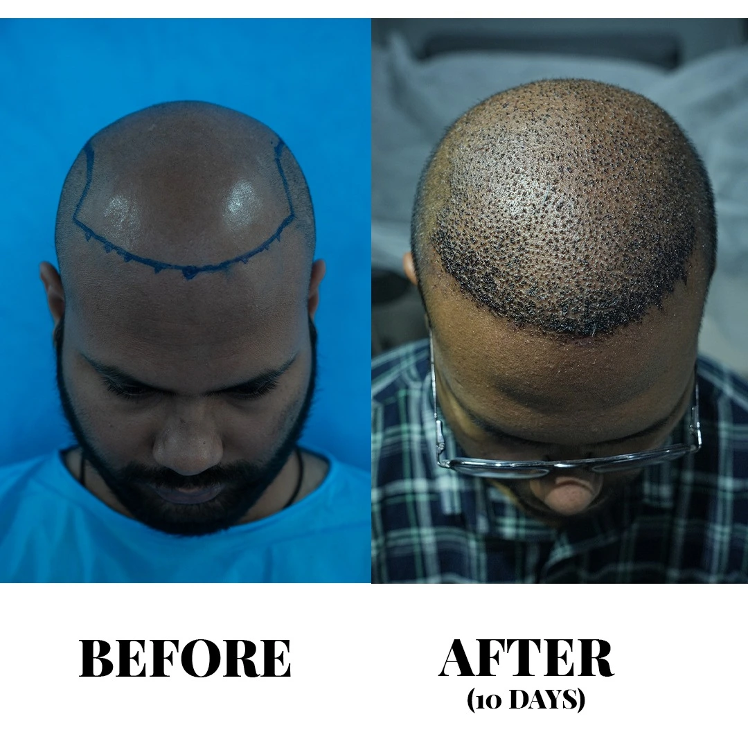 Treatment result
