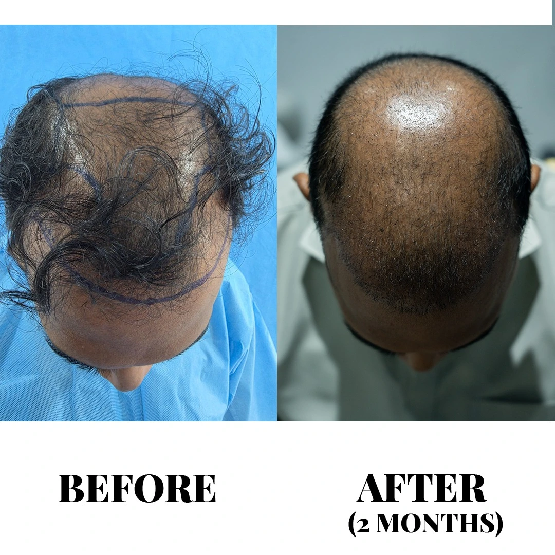 Treatment result