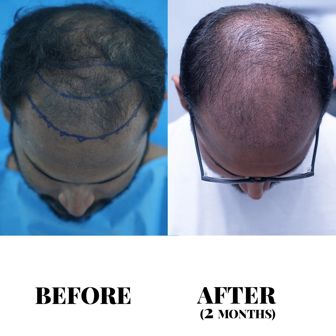 Treatment result