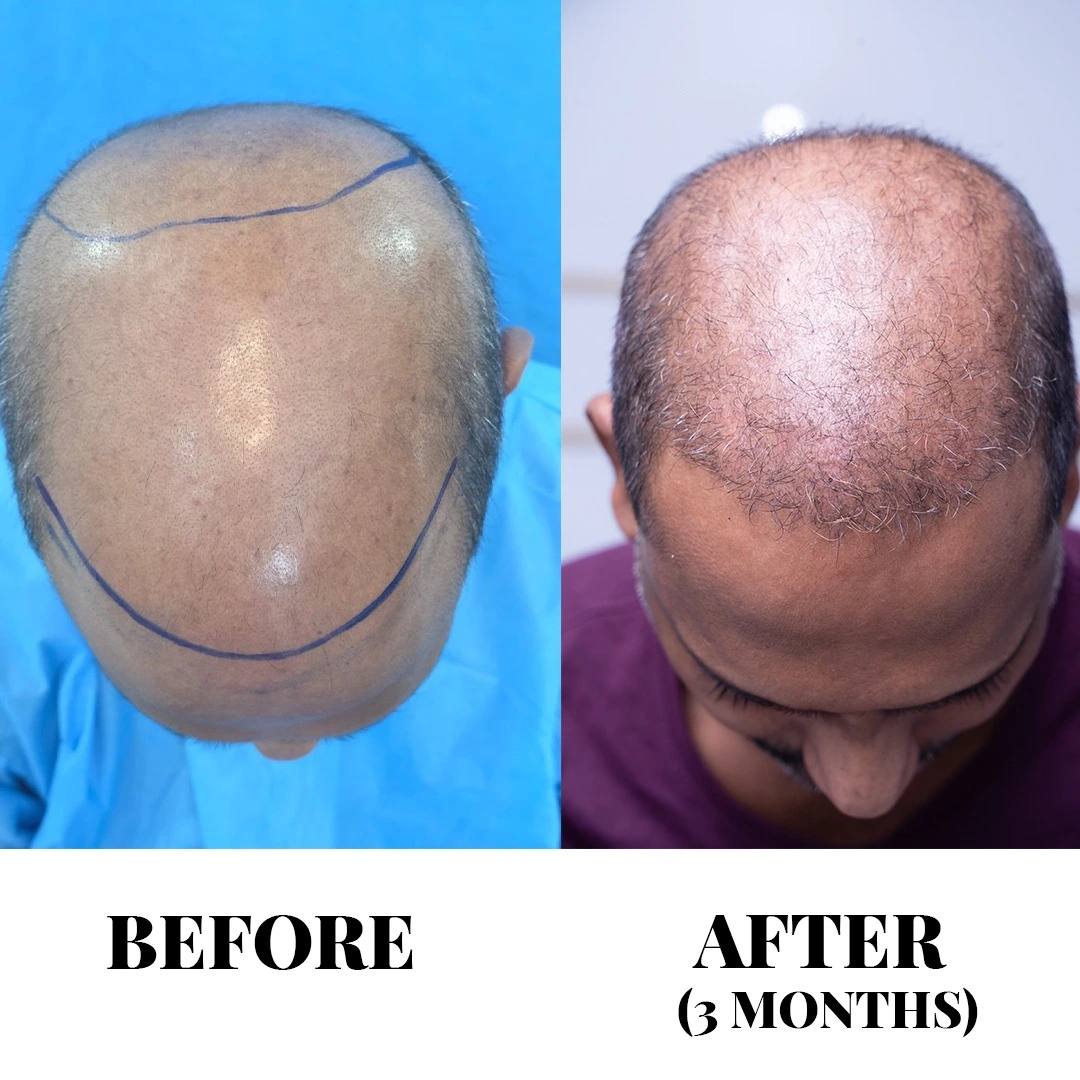 Treatment result