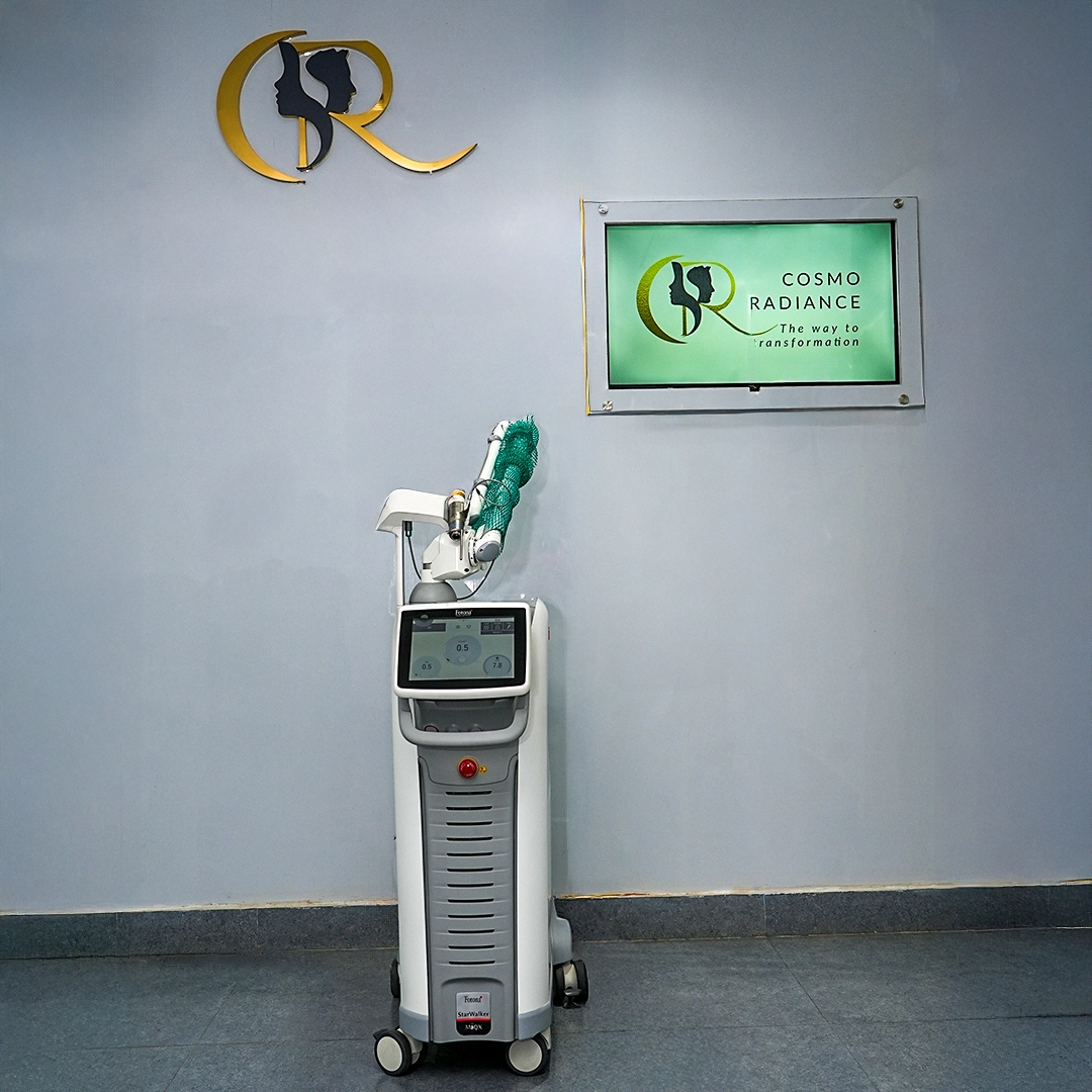 Fotona Starwalker Pico Q-Switched Laser for tattoo removal and skin rejuvenation at Cosmo Radiance