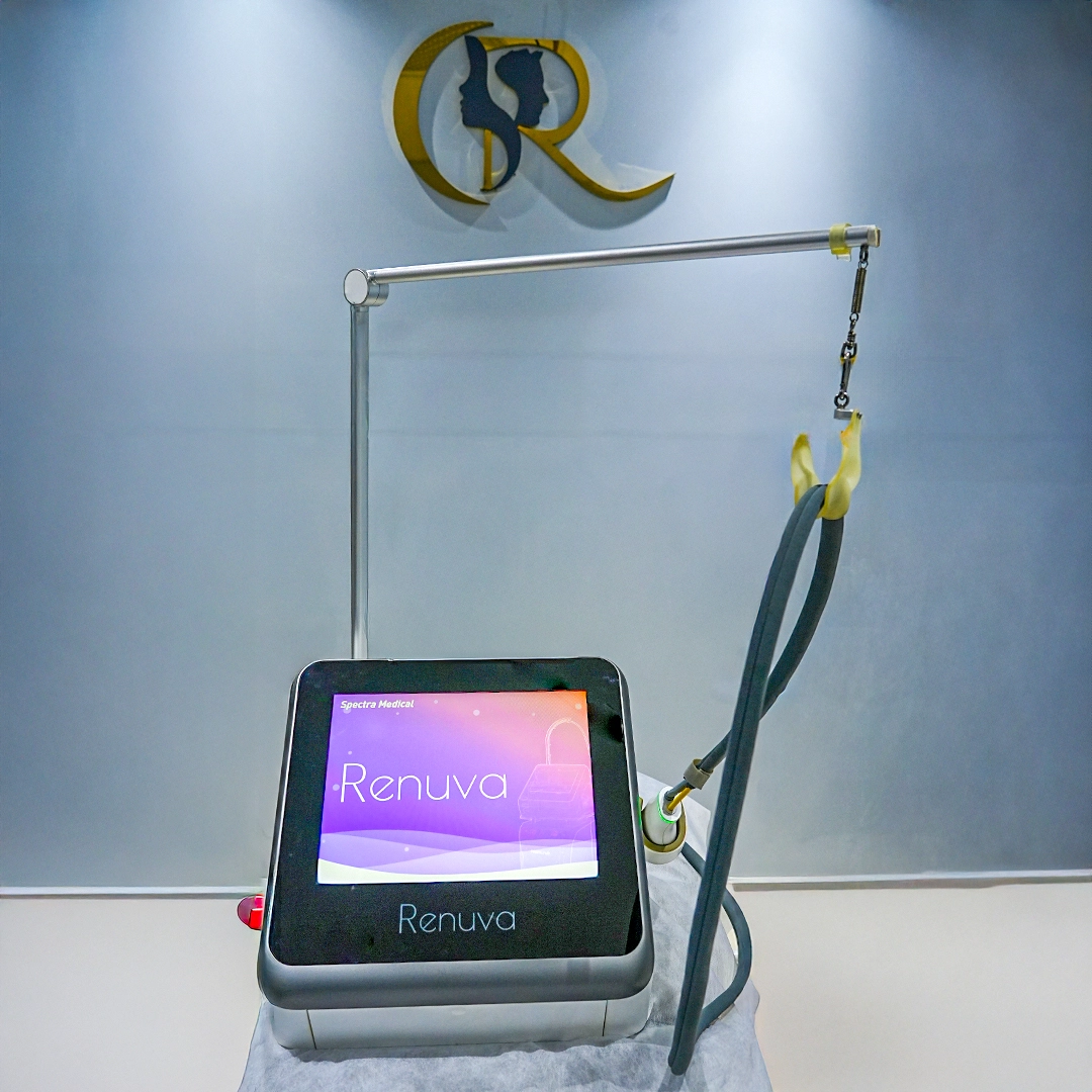 Renuva Erbium Glass Laser System for skin resurfacing