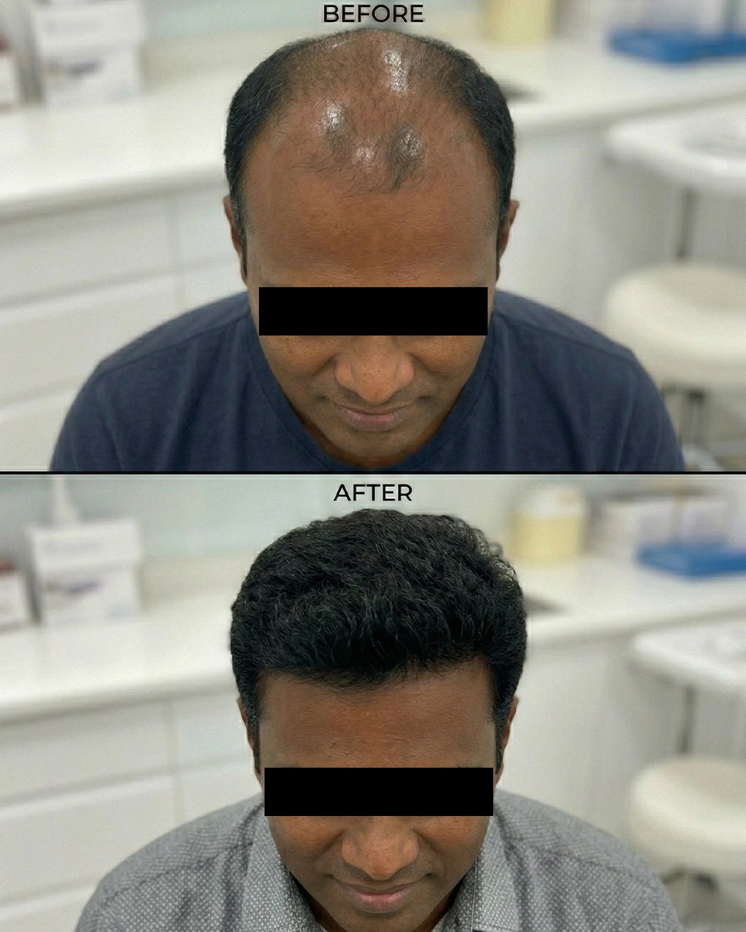 Treatment result