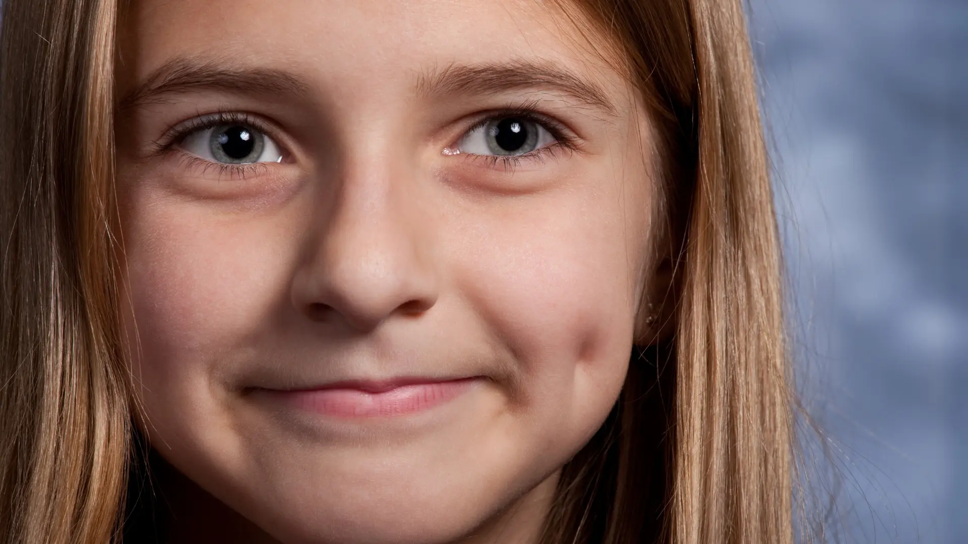 Dimple Creation At Cosmoradiance