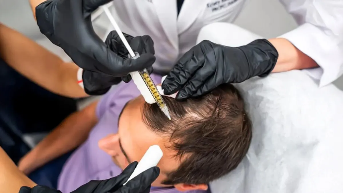 Advanced GFC Hair Treatment in Hyderabad | GFC Cost & Benefits