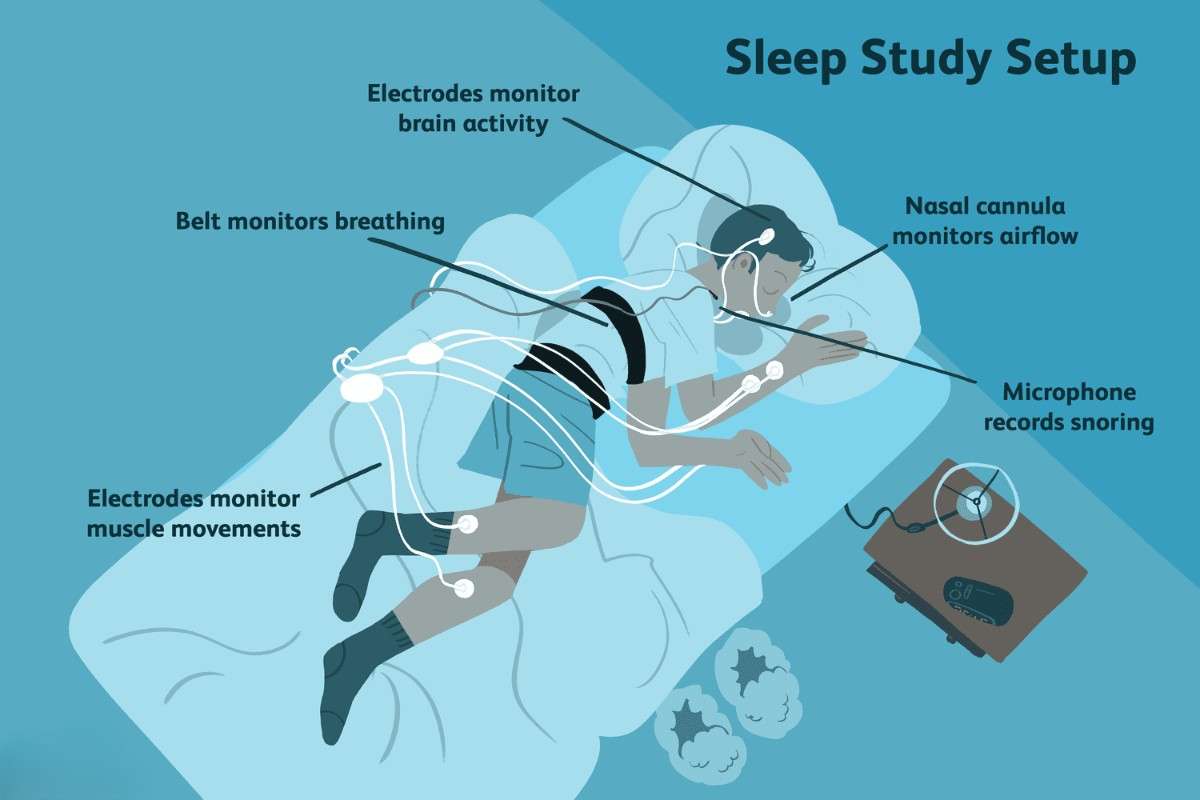 Advanced sleep study monitoring equipment at Cosmo Radiance clinic in Hyderabad
