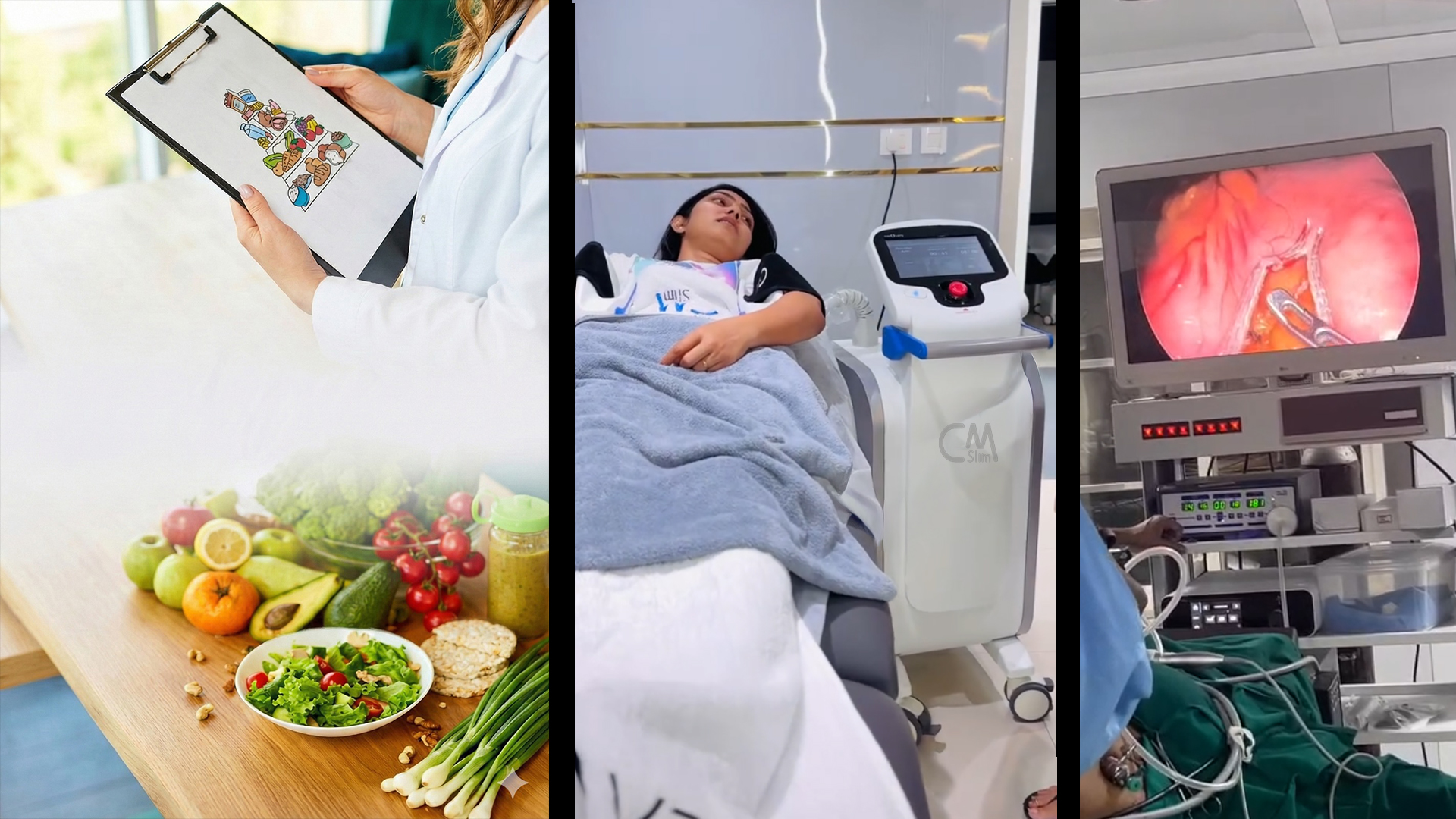 Weight Loss Bariartic Surgery